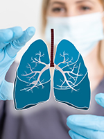 Quick Quiz: Lung Cancer